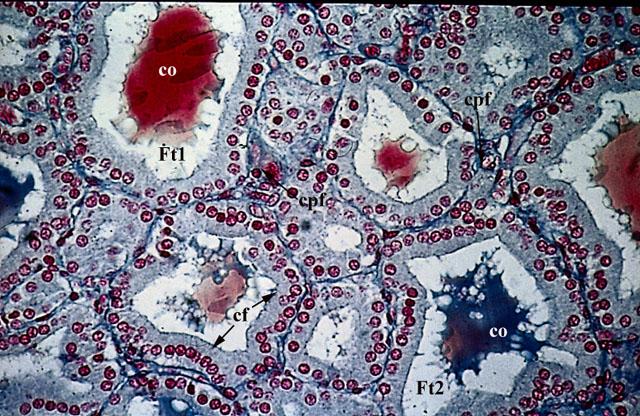 Follicoli tiroidei al microscopio